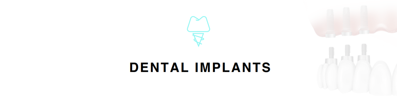 DentalImplants